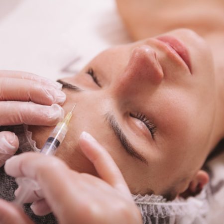 Brow Lift