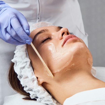 Chemical Peels